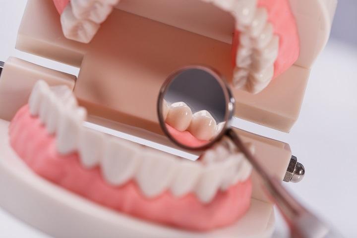 Керамические коронки для зубов: нюансы выбора