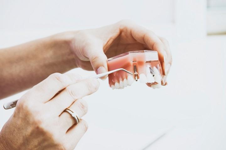 Протезирование зубов и его разновидности