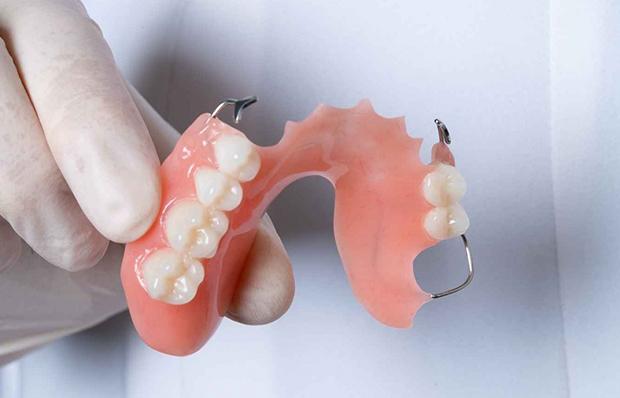 Временные зубные протезы