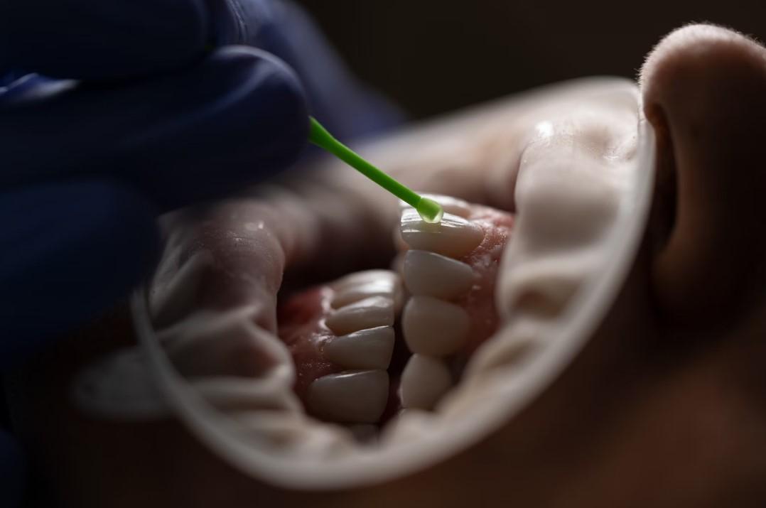 Что такое гипоплазия эмали зубов